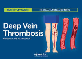 deep vein thrombosis nursing care management and study guide