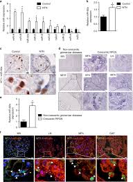 Klinik kt poliklinik dan surgeri. Genetic And Pharmacological Inhibition Of Microrna 92a Maintains Podocyte Cell Cycle Quiescence And Limits Crescentic Glomerulonephritis Nature Communications