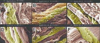 Tendons play an important role in the movement by transmitting the contraction force produced by the muscles to the bone they hold, and their contribution to stability to the joints is extremely important. Scanning Electron Microscopy Of Different Stages Of Tendon Healing A Download Scientific Diagram