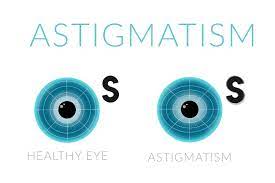 Irregular astigmatism is a relatively rare form of astigmatism in which the principal meridians of the cornea are not 90 degrees apart from each other. Can You Improve Astigmatism Naturally