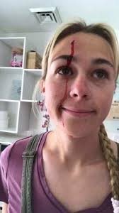 Colorado residential centers say there's not enough staff to keep kids safe