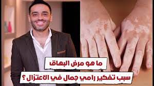 We did not find results for: Ù…Ø§ Ù‡Ùˆ Ù…Ø±Ø¶ Ø§Ù„Ø¨Ù‡Ø§Ù‚ Ø³Ø¨Ø¨ ØªÙÙƒÙŠØ± Ø±Ø§Ù…ÙŠ Ø¬Ù…Ø§Ù„ ÙÙŠ Ø§Ù„Ø§Ø¹ØªØ²Ø§Ù„ Youtube