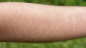 how to get rid of arm hair