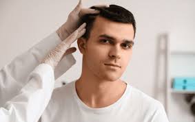 FUT Hair Transplant Surgery: Restoring Hairline Permanently
