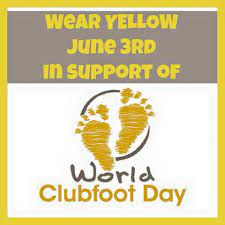 World clubfoot day increases awareness of congenital clubfoot birth defect and the ponseti method, the noninvasive manipulation, casting and bracing which delivers a 97% correction rate. Worldclubfootday Hashtag On Twitter