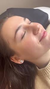 Transform your skin with a Vampire Facial! Also known as PRP therapy, this  treatment uses your body's own natural growth factors to restore a youthful  glow. By stimulating collagen production and cell