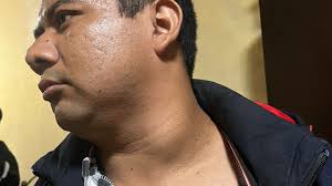 Fundraiser by Noe Alejandro Fuentes del rosario : Ayúda a Noe a vencer el  cancer.