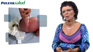 Aspecto Normal De Las Heces Del Bebe Www Pulevasalud Tv Youtube