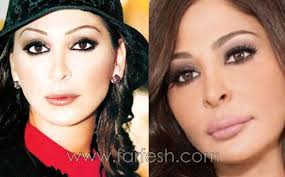 مايا دياب قبل وبعد التجميل. Mosalsalatpro Com Ù…ÙˆÙ‚Ø¹ Ù…Ø³Ù„Ø³Ù„Ø§Øª ØµÙˆØ± Ø§Ù„ÙÙ†Ø§Ù†Ø§Øª Ù‚Ø¨Ù„ ÙˆØ¨Ø¹Ø¯ Ø¹Ù…Ù„ÙŠØ§Øª ØªØ¬Ù…ÙŠÙ„ ØªÙƒØ¨ÙŠØ± Ø§Ù„Ø´ÙØ§Ù‡