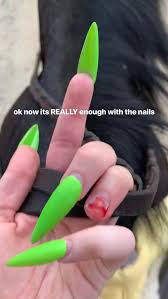 Acyclic nails have got a bad rep in the past. Billie Eilish Accidentally Rips Off Nail And Shared Gruesome Photo On Instagram People Com