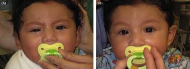 Image result for Tensilon Test