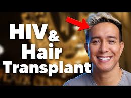 Getting a Hair Transplant (with HIV)