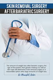Pin On Plastic Surgery After Wls