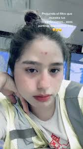 Por Qué En Los Filtros Me Salen Puntitos Al Tomar Una Foto