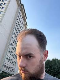 Did the dang thing : r/bald