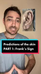 Who knew earlobe creases can be so crucial #dermatologist #skindoc #skin  #wrinkles #heartattack #atherosclerosis