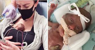 Babies born at 27 weeks are considered extremely premature and require a high level of care. Baby Born At 22 Weeks Defies The Odds To Survive