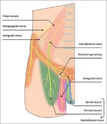 The pain starts at the back of one testis. View Image