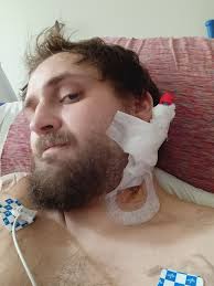 How to exchange shoes as a new amputee in Reno, NV?