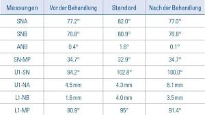 4 introduction the bolton analysis has been designed following observation that tooth size was important to ideal occlusion bolton. Paradigmenwechsel In Der Kfo Behandlung Zwp Online Das Nachrichtenportal Fur Die Dentalbranche