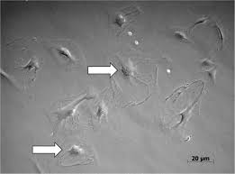 The nucleolus is responsible for making ribosomes. Two Nuclei Inside A Single Cardiac Muscle Cell More Questions Than Answers About The Binucleation Of Cardiomyocytes