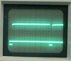 Hulda Clark Zapper Comparison Chart Best Zappers