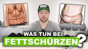 Richtig abnehmen um Hautlappen und Fettschürzen zu vermeiden - YouTube