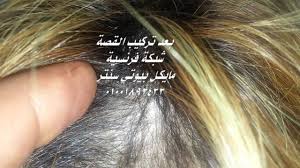 تركيب قصة شبكة فرنسية شعر طبيعي والنتيجة قبل وبعد لحالات الشعر الخفيف من مقدمة الرأس Youtube