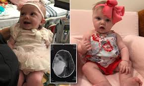 The difference between the two is that malignant tumors are cancerous and can spread rapidly into other parts of the brain, sending cancerous cells into surrounding tissue. Baby Girl 9 Months Hailed A Miracle For Surviving Rare Tumor That Was Taking Up 60 Of Brain Daily Mail Online