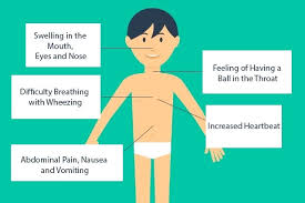 Severe, immediate, potentially fatal bodily reaction to contact with a substance ( antigen ) to which the individual has previously been exposed. Anaphylactic Shock What Is This And How Can It Be Treated