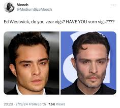 Harry Styles and the Turkish Hair Transplant