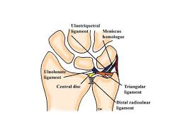 Image result for Triangular Fibrocartilage Complex Injury