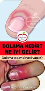 Dolama Nedir Dolama Nasil Tedavi Edilir Eye Care Skin Problems Oral Care