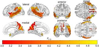 Come into use until several decades later when wing (4). The Connectomes Of Males And Females With Autism Spectrum Disorder Have Significantly Different White Matter Connectivity Densities Scientific Reports