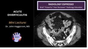ACUTE DIVERTICULITIS: Mini Lecture, Dr. John Haggstrom, MD