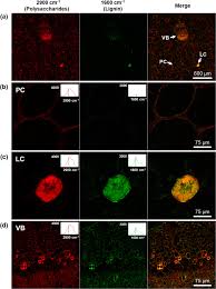 We did not find results for: Label Free Visualization Of Lignin Deposition In Loquats Using Complementary Stimulated And Spontaneous Raman Microscopy Horticulture Research
