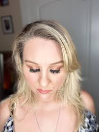 Living with chronic pain after back surgery