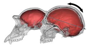 Image result for Parietal Bone