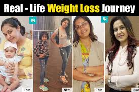 Real-Life Weight Loss Journey: With No Exercise, And PCOS, Khyati Rupani  Loses 40 Kilos