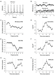 Time Course Of Heart Rate Variability Electroencephalographic Eeg Download Scientific Diagram