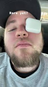 Haha rare yet? #fyp #viral