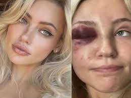 Cirurgião plástico de Nova York é acusado de transformar modelo em 'escrava  sexual'