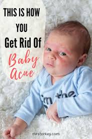 Another option when you notice rosy red cheeks is to run cool water over your little one's skin. Why Do Babies Get Acne Read On These Comprehensive Tips On How To Get Rid Of Baby Acne Naturally Your Little One Dese Baby Acne Newborn Acne Baby Acne Remedy