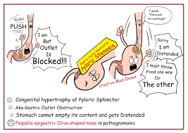 Image result for Succussion Splash