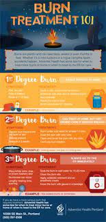 Burn Safety Tips For Summer Burns Treatment Burns Treatment