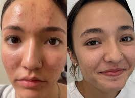 Mallory Terry, Laser Professional (@beautyarts.mallory) • Instagram photos  and videos