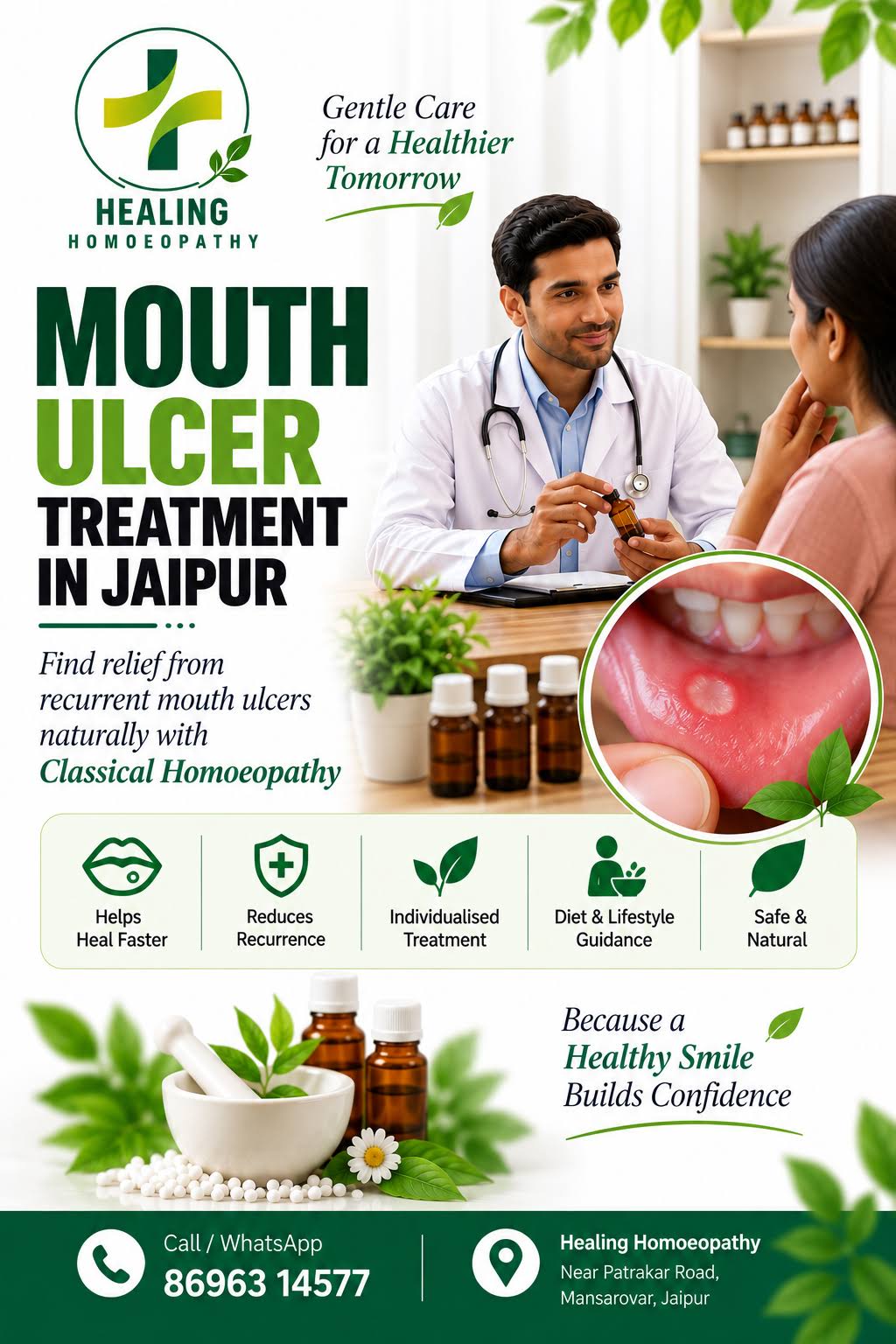 MOUTH ULCER