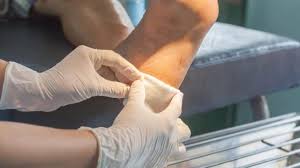 Diabetic wound care specialist near me. Diabetic Neuropathy Management And Related Ulcers Healogics