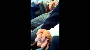Mirror syndrome or triple edema or ballantyne syndrome is a rare disorder affecting pregnant women. Congenital Mirror Syndrome Youtube