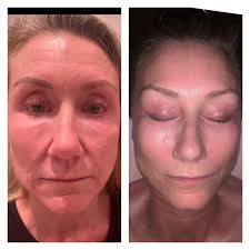 Beach Cottage Day Spa (@beachcottagedayspasb) • Instagram photos and videos